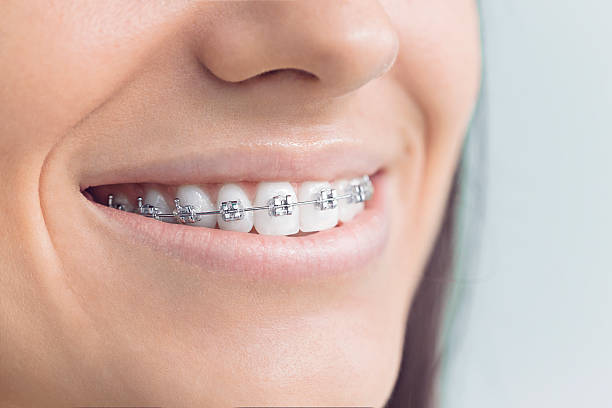 Best Wisdom Tooth Removal  in Jersey City, NJ
